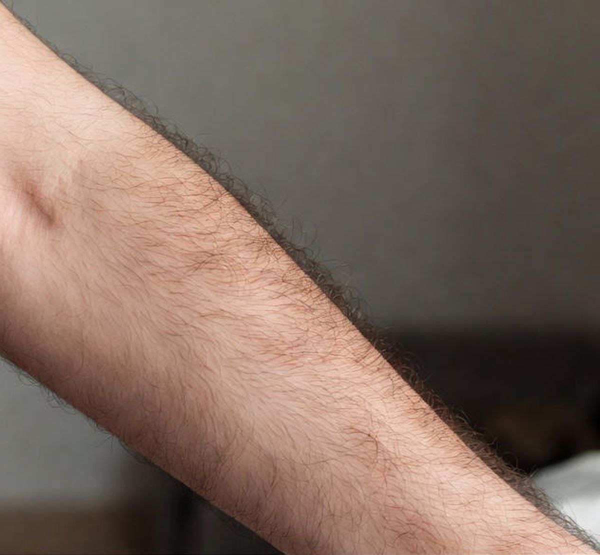 قبل آرنج قبل آرنج